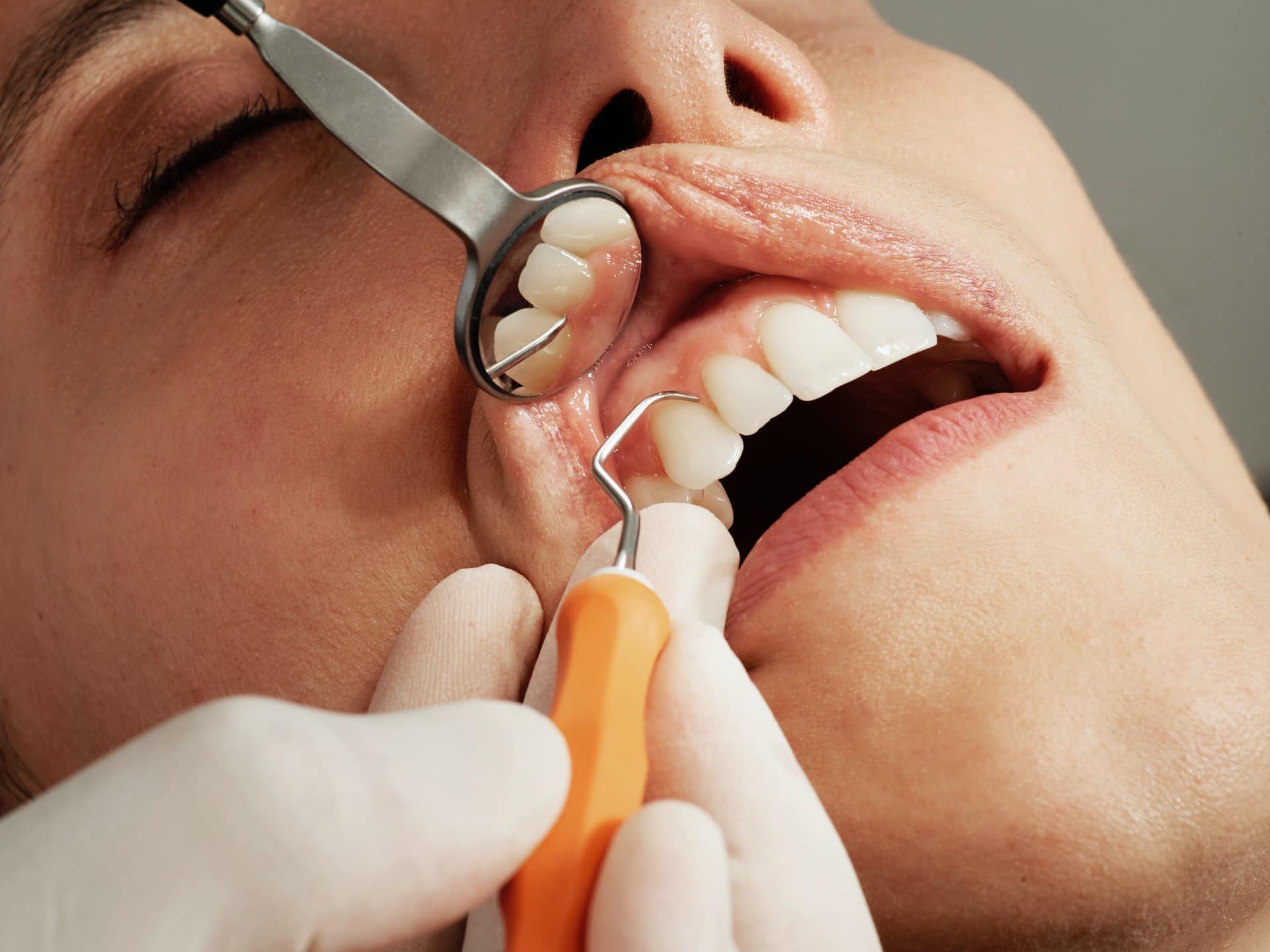 Tooth sensitivity - teeth examination