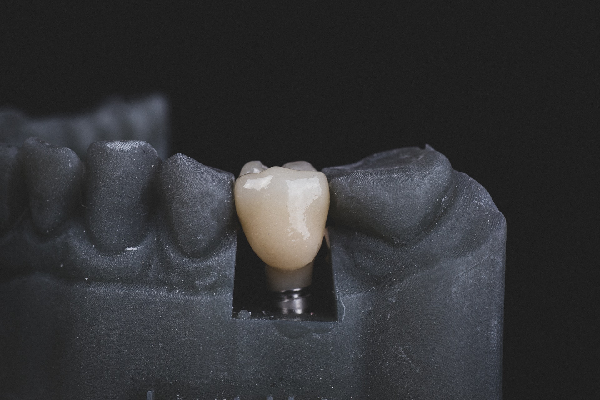 bridges and implants - black and white image of teeth and jaw with dental implant and crown shown in color.